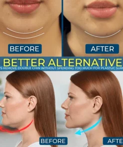 Définisseur de mâchoire V-Lab