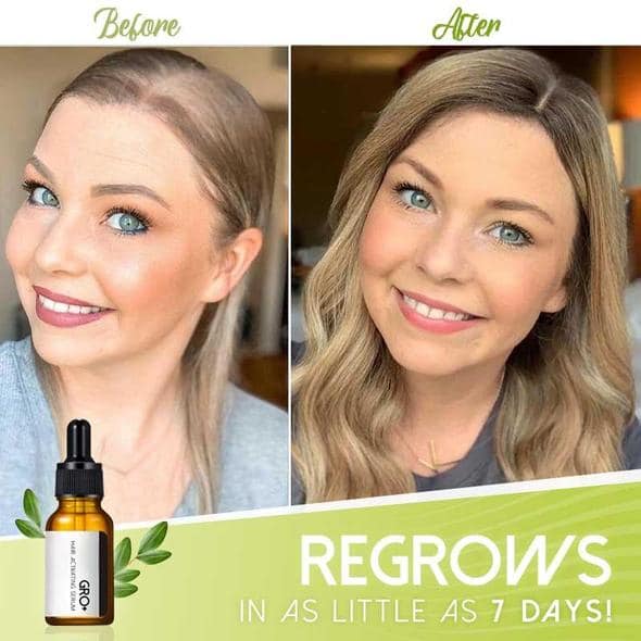 Sérum activateur capillaire Gro+ - Image 3