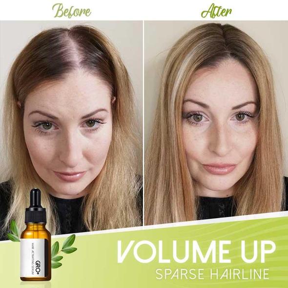 Sérum activateur capillaire Gro+ - Image 4