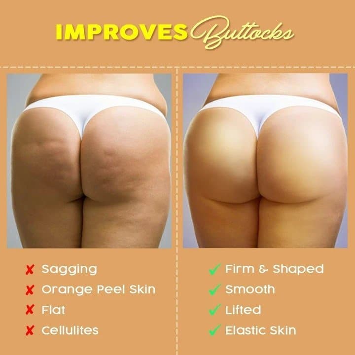 Patch de mise en forme pour le lifting des fesses (6 pièces/ensemble) - Image 4