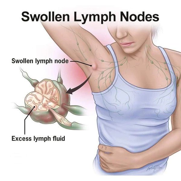 Patch de soin lymphatique Biolita (5/10/20 pcs) - Image 6