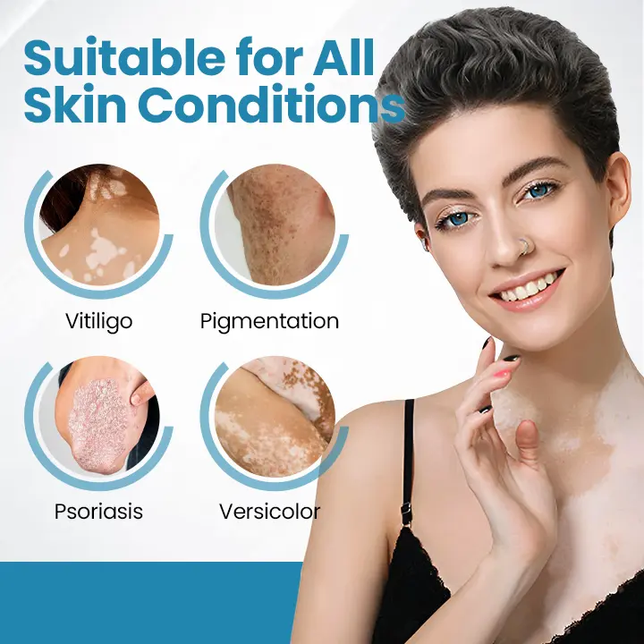 Appareil de thérapie contre le vitiligo Acezozla® DermaBeam - Image 2