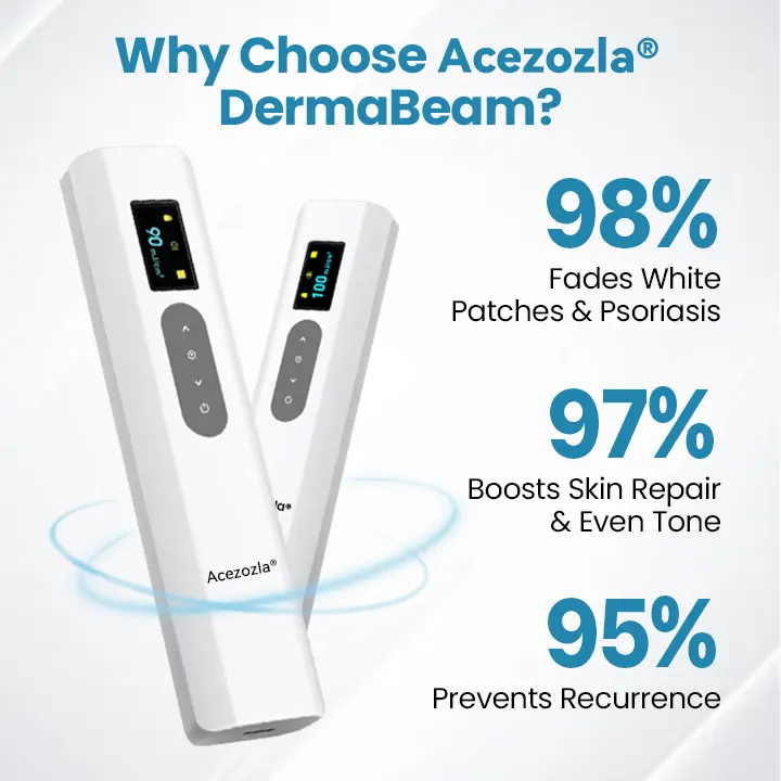 Appareil de thérapie contre le vitiligo Acezozla® DermaBeam - Image 6