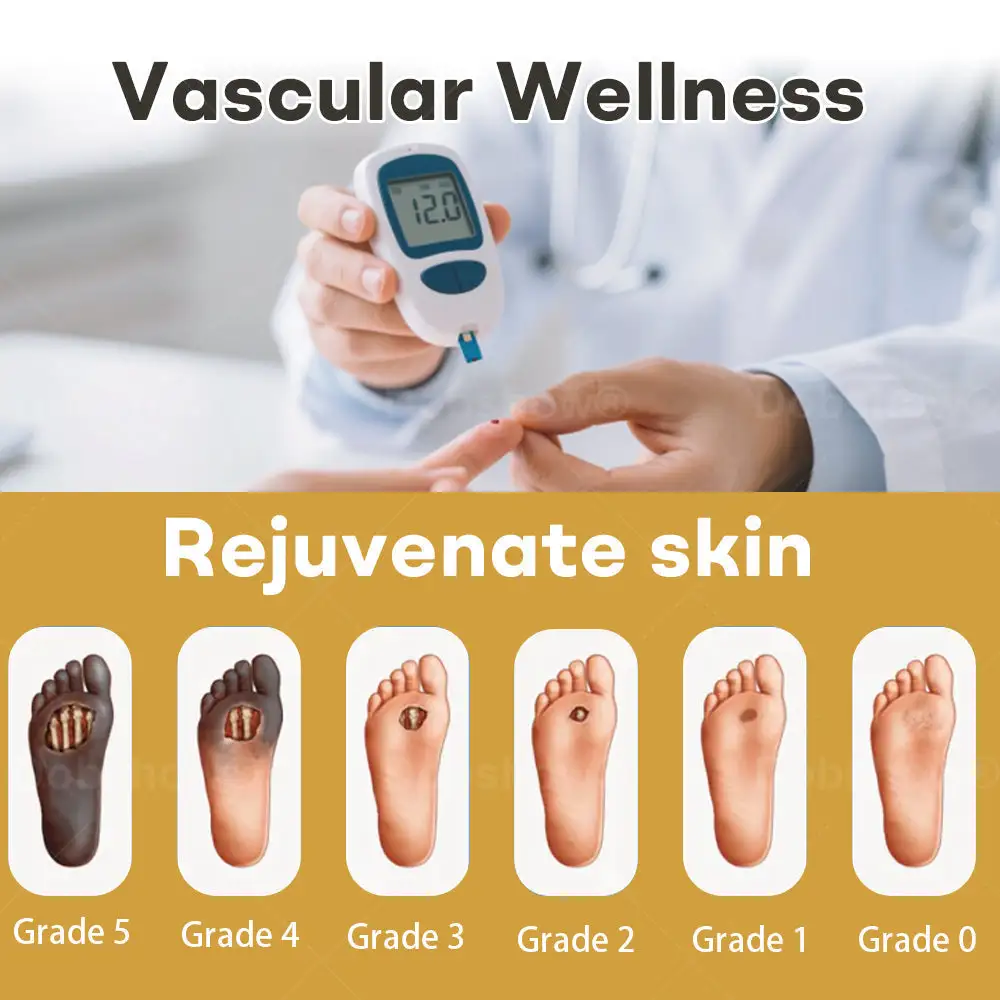 Spray pour plaies au venin d'abeille Acezozla® GlucoShield - Image 2