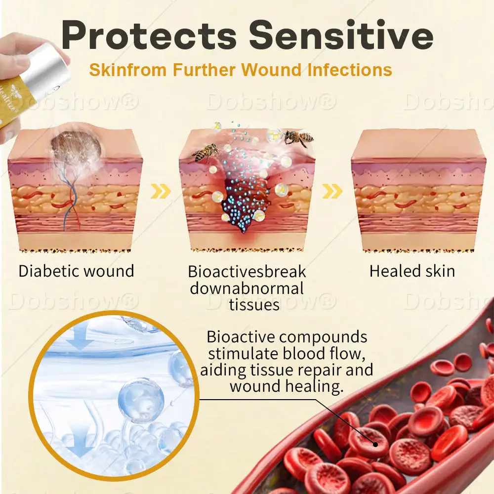 Spray pour plaies au venin d'abeille Acezozla® GlucoShield - Image 3