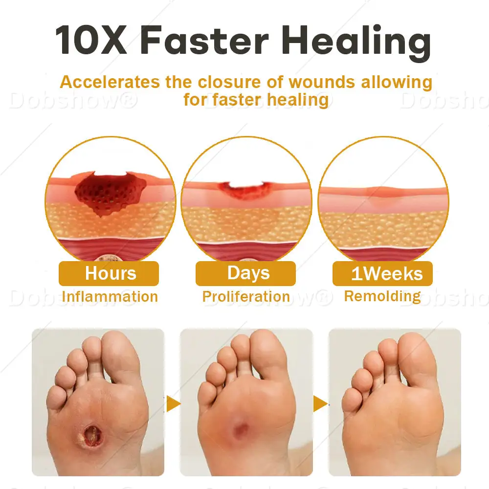 Spray pour plaies au venin d'abeille Acezozla® GlucoShield - Image 4