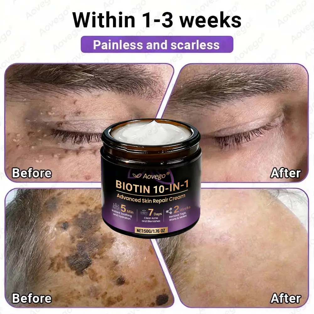 Crème réparatrice avancée pour la peau Aovego® BIOTIN 10-EN-1 - Image 10