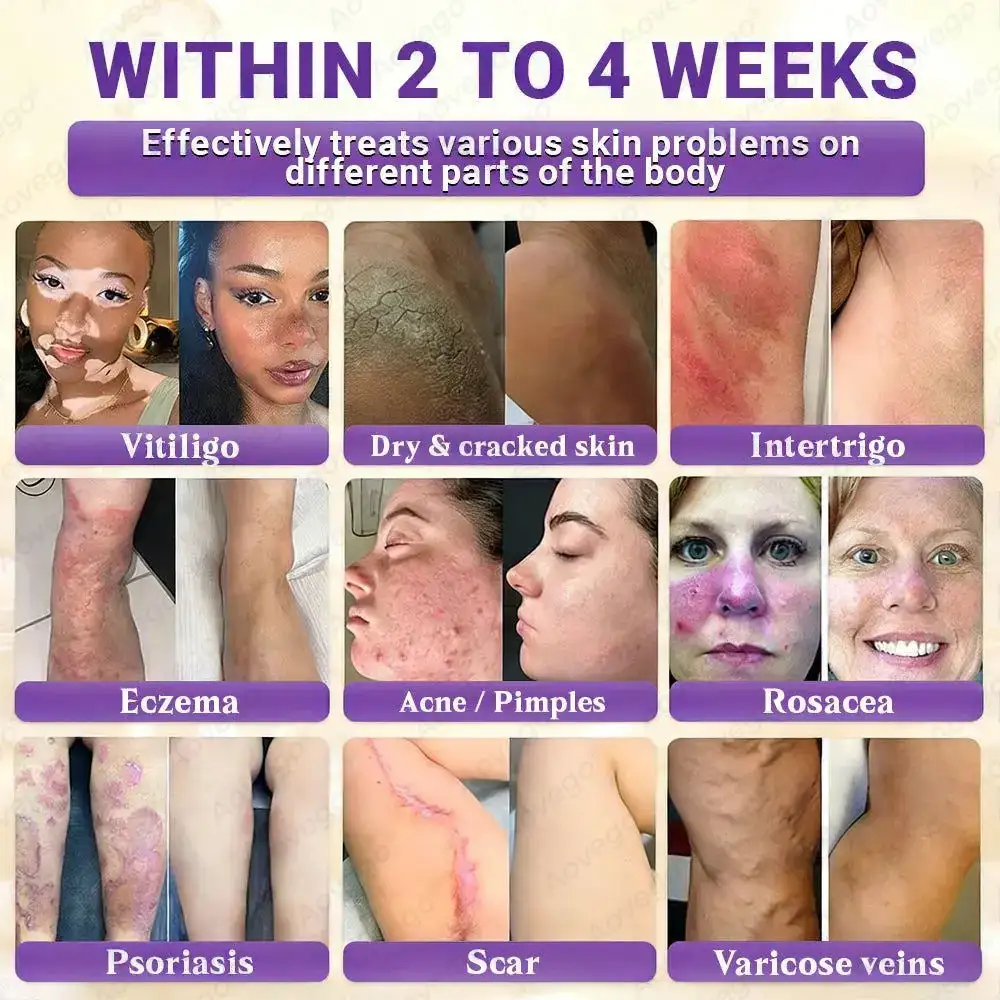 Crème réparatrice avancée pour la peau Aovego® BIOTIN 10-EN-1 - Image 2