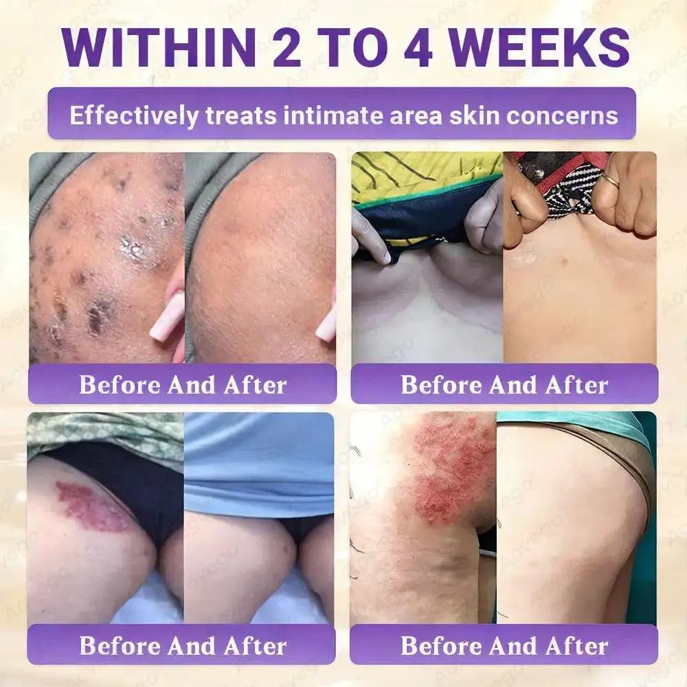 Crème réparatrice avancée pour la peau Aovego® BIOTIN 10-EN-1 - Image 3