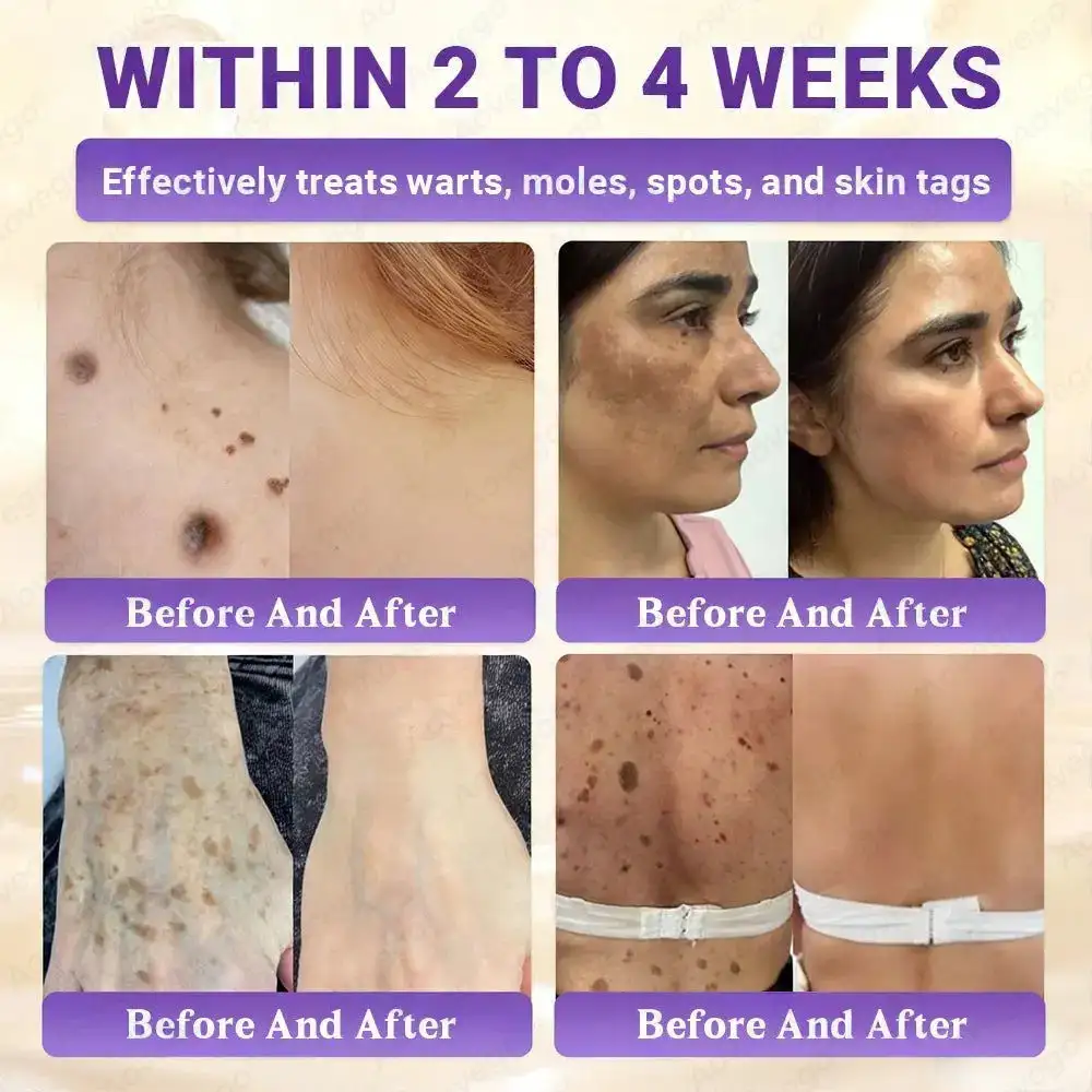 Crème réparatrice avancée pour la peau Aovego® BIOTIN 10-EN-1 - Image 4