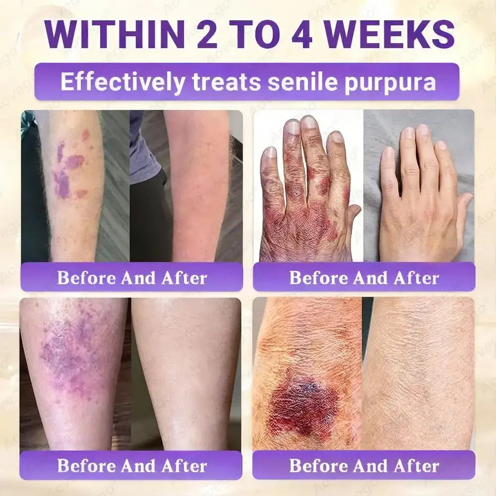 Crème réparatrice avancée pour la peau Aovego® BIOTIN 10-EN-1 - Image 7