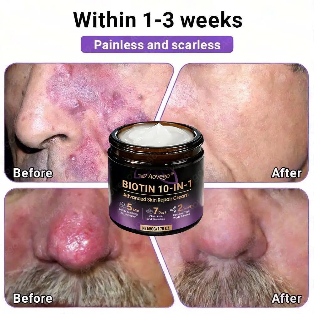 Crème réparatrice avancée pour la peau Aovego® BIOTIN 10-EN-1 - Image 8