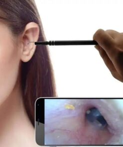 Caméra de sélection d'oreille d'endoscope